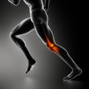 Cartilage Damage: Causes, Diagnosis, and Treatments, TPL Orthopedics and Sports Medicine