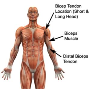 Long Head of Biceps Rupture on the Shoulder, TPL Orthopedics and Sports Medicine