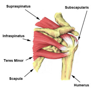 Rotator Cuff Strain / Tear, TPL Orthopedics and Sports Medicine