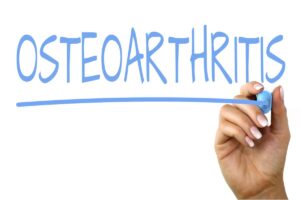 What is the best treatment for osteoarthritis?, TPL Orthopedics and Sports Medicine