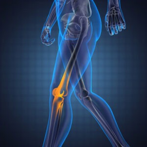 Physical Therapy May Be Your Solution to Knee Pain | Las Vegas