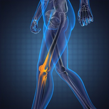 How Long Does It Take to Recover From Total Knee Surgery?, T&amp;P Orthopedics and Sports Medicine