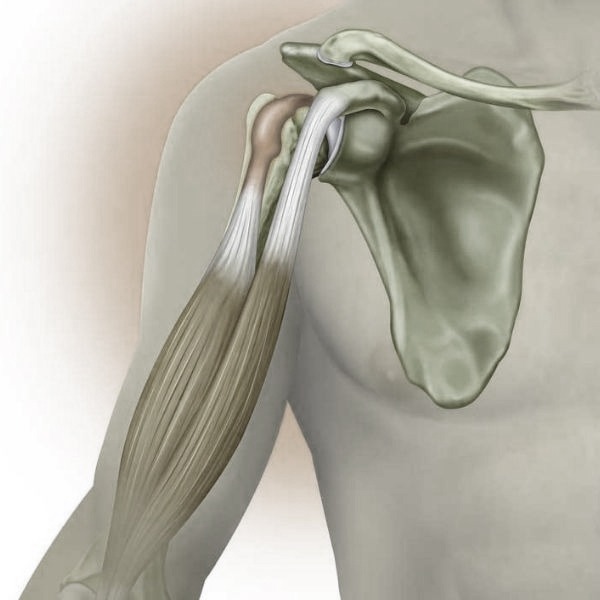 Bicep Tenodesis, TPL Orthopedics and Sports Medicine