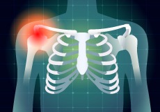Shoulder Socket Fracture (Glenoid Fracture), T&amp;P Orthopedics and Sports Medicine