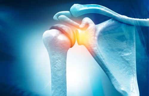 Shoulder Impingement, T&amp;P Orthopedics and Sports Medicine